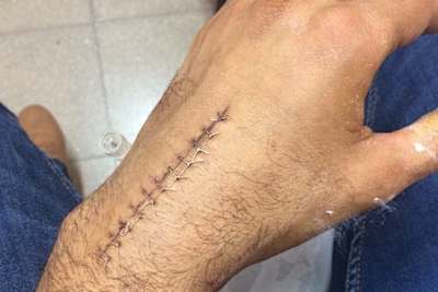 Leandro Mercado wird ein Andenken von seinem Sturz zurückbehalten