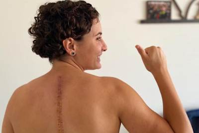 Ana Carrasco wird die Narbe lebenslang als Andenken an den Estoril-Sturz behalten