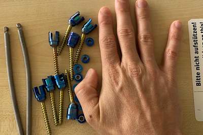 Sandro Cortese hatte einiges Metall im Rücken