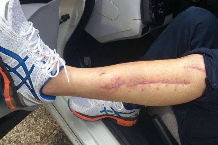 Gabor Talmacsi: Die Wunden sind fast verheilt