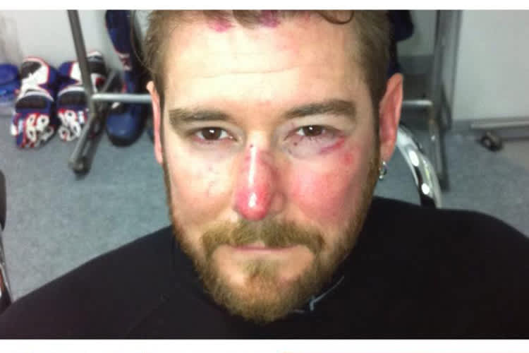 Damian Cudlin: Böser Abflug in Japan