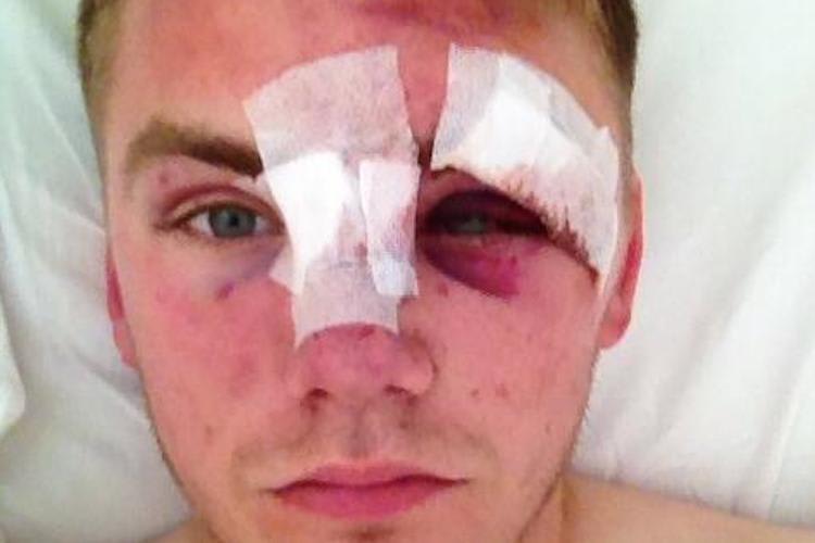 Harry Stafford hat es in Imola schwer erwischt