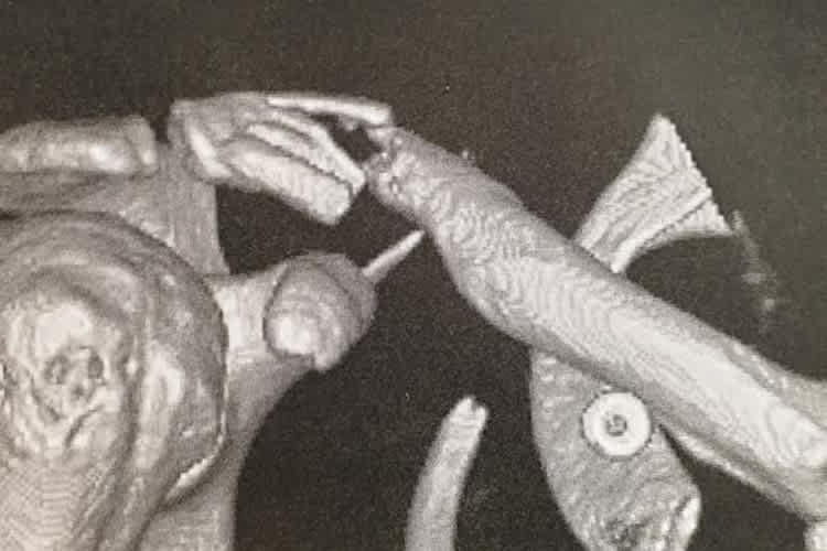 Gines Schlüsselbein kurz vor dem Rennen