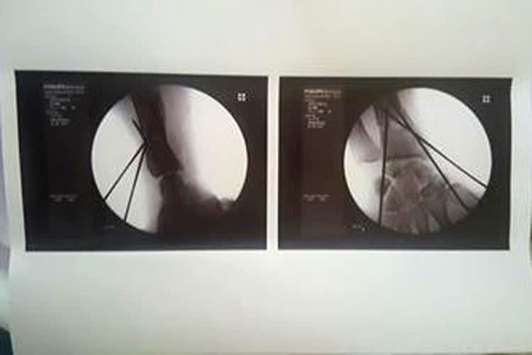 Ein Arm von Mathieu Gines