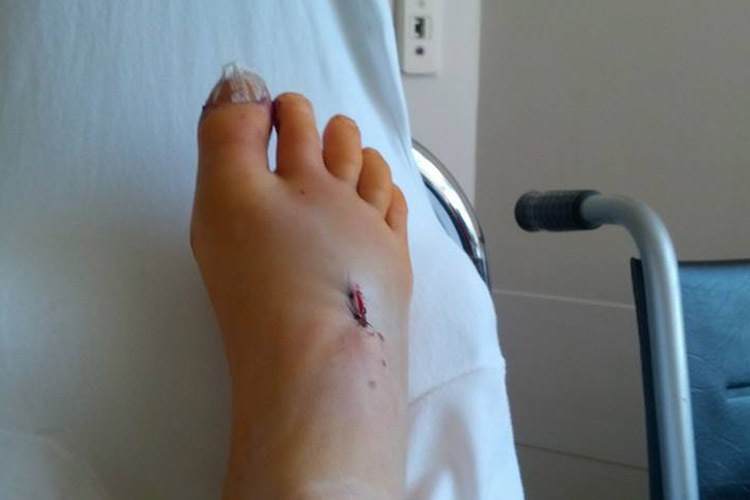 Katrin Meyers Fuss frisch verdrahtet