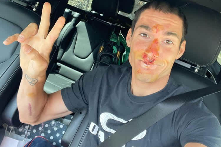 Mit dem Mountain Bike gestürzt: Aleix Espargaró 