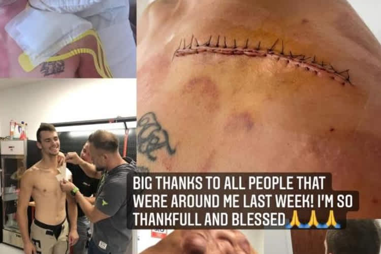 Tim Gajser veröffentlichte Bilder seines operierten Schlüsselbeins