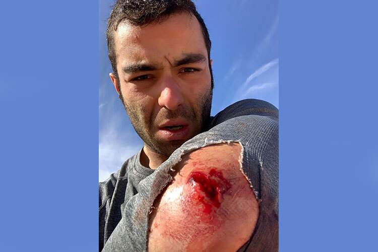 Danilo Petrucci: Tiefe Wunde am linken Oberarm