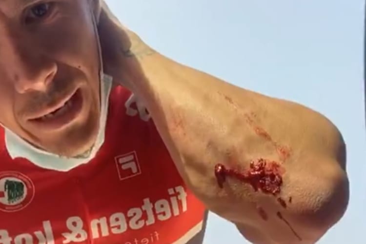 Scott Redding präsentiert seine Wunde am Ellbogen