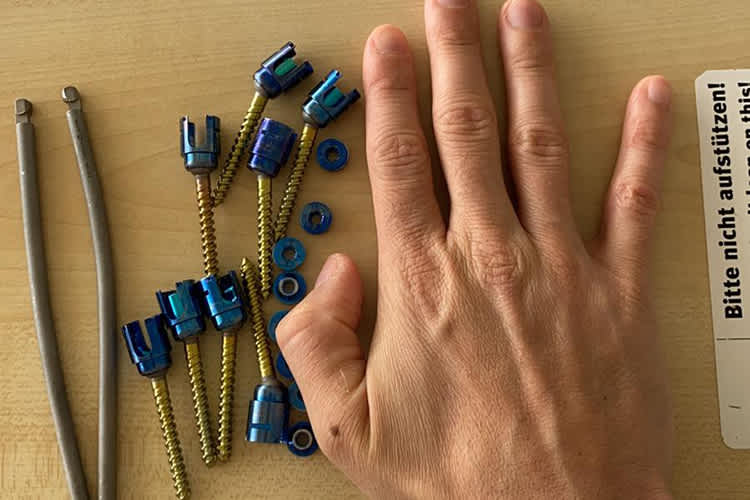 Sandro Cortese hatte einiges Metall im Rücken