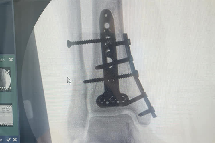 Van der Mark vor Bautista und Nozane