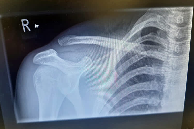 Ein Foto aus Schleiz