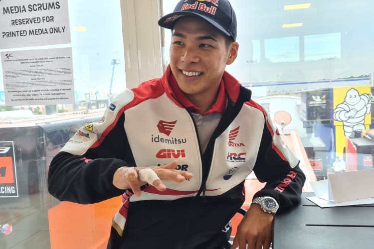 Takaaki Nakagami zeigt seine Verletzung. Der kleine Finger bleibt weiterhin abgeknickt.