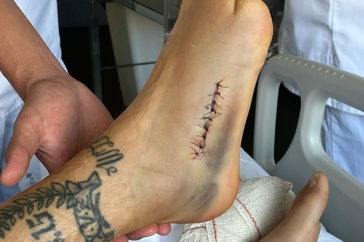 Xavi Vierge erholt sich von der Operation