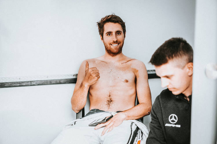 Deutlich zu sehen: Die Narbe an der Schulter