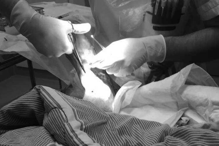 Günther Bauers Fuß: Die Fäden sind gezogen