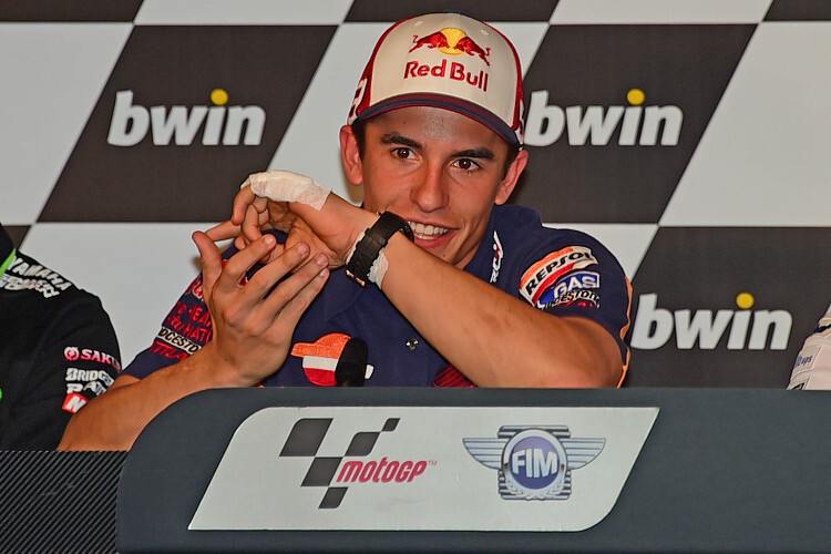 Márquez brach sich beim Dirt-Track den linken kleinen Finger