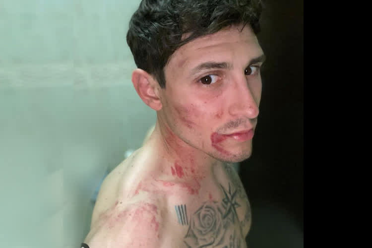 Ivo Monticelli stürzte im ersten MXGP-Lauf von Orlyonok