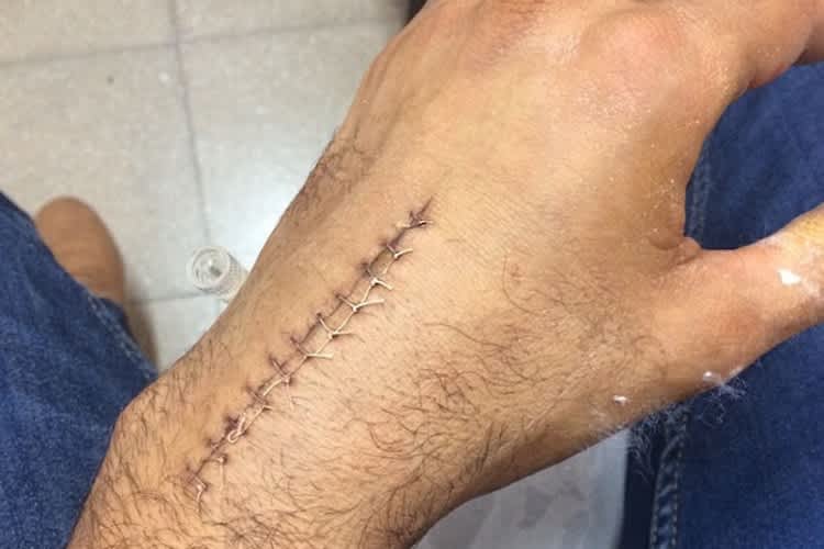 Leandro Mercado wird ein Andenken von seinem Sturz zurückbehalten