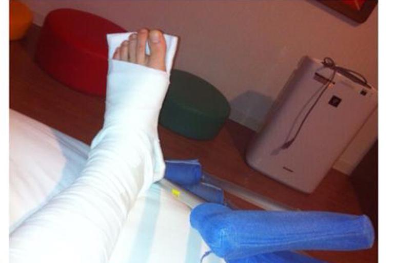 Cudlins Schienbein in Gips