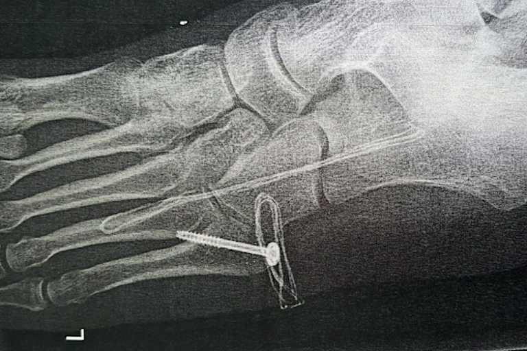 Matti Seidel: Eine weiteres Exemplar seiner Schrauben-Sammlung