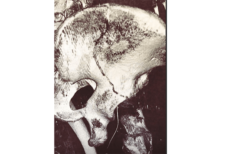 Der Riss in Aegerters Beckenschaufel ist klar zu erkennen