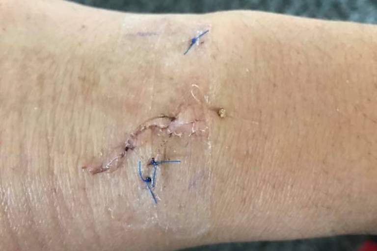 Die Narben sind überschaubar