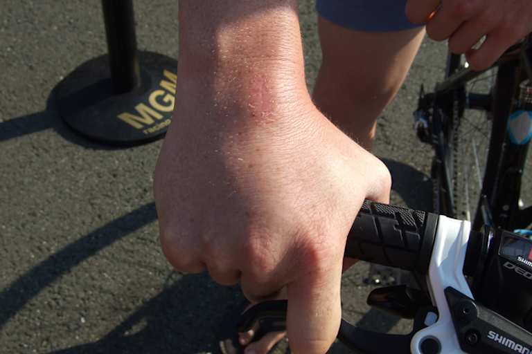 Das Handgelenk wird auf die Probe gestellt