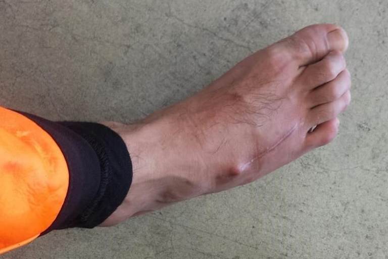 Die lockere Schraube ist offensichtlich 