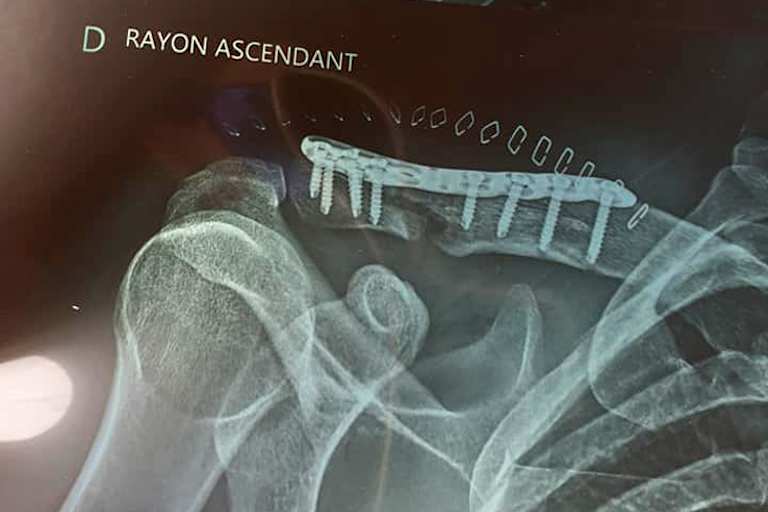 Vor dem Titelgewinn noch unterm Messer