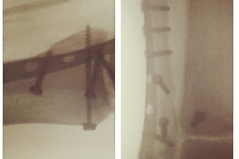 Aus dem privaten Foto-Archiv von Luca Grünwald