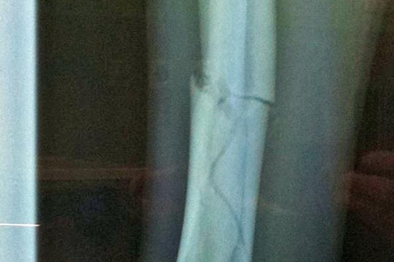 Der Kawasaki-Pilot will bald wieder fahren