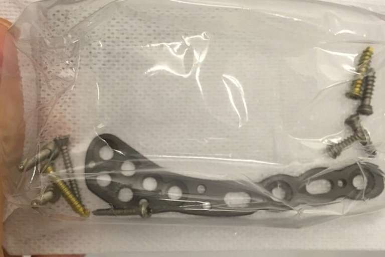 Miller scherzte: «War heute im Eisenwarenladen. Fühle mich auf der rechten Seite nun leichter.»