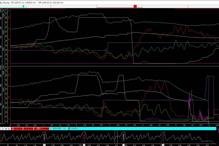 Die Daten des tragischen Unfalls wurden mit jenen der schnellsten Runde des Spaniers verglichen