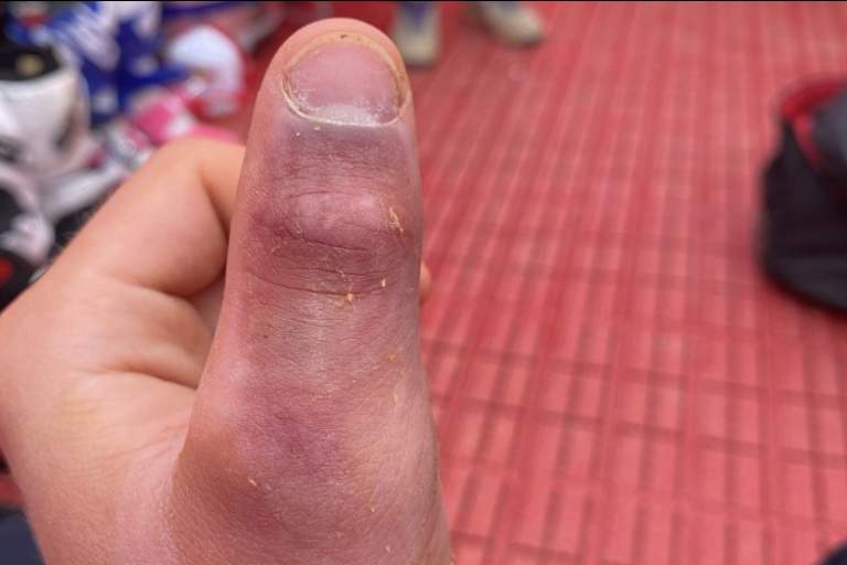 Ein dicker Daumen als Andenken aus Agueda