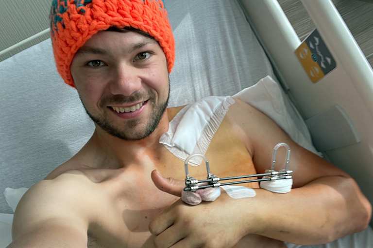 Der Armschmuck gehört der Vergangenheit an