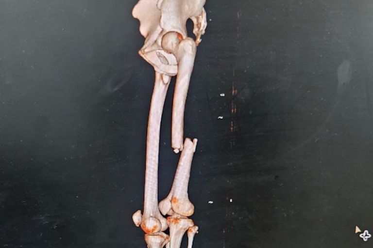 So sah sein Oberschenkelknochen vor der Operation aus