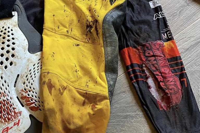 Die blutverschmierten Rennklamotten von Jonass nach dem Crash von Loket