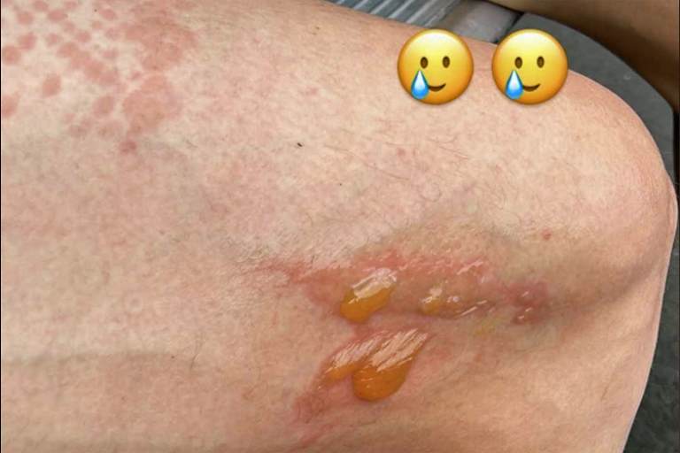 Caricasulos gegrillter Schenkel