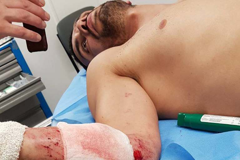 Kenan Sofuoglu direkt nach seinem Sturz in Australien