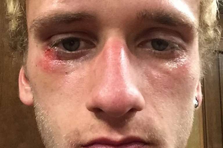 Der Suzuki-Pilot postete bei Instagram von sich dieses Foto