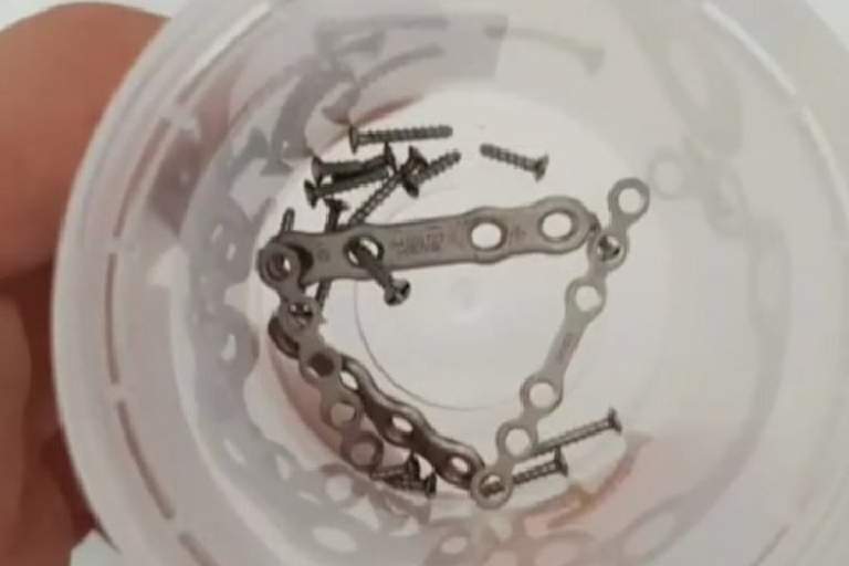 Edles Titan wurde Tim Gajser aus dem Kiefer entfernt