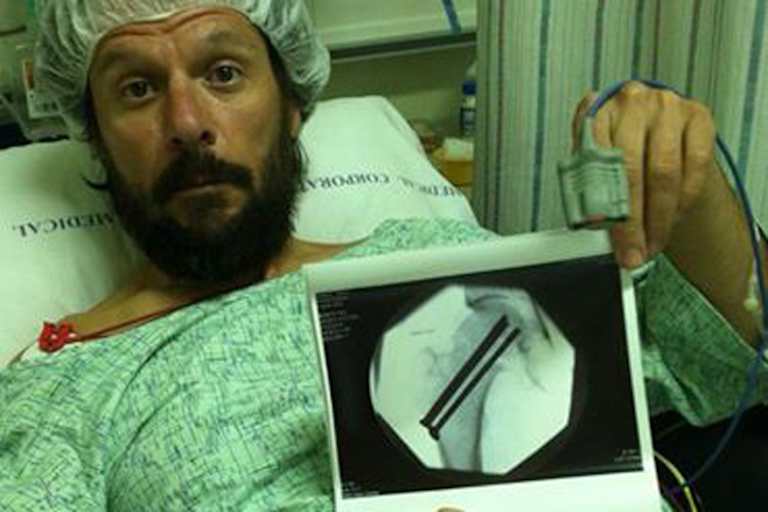 Aaron Yates mit dem jüngsten Röntgenbild